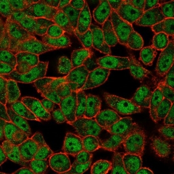 Immunofluorescent staining of PFA-fixed human HeLa cells with GCM2 antibody (clone PCRP-GCM2-1B3) followed by goat anti-mouse IgG-CF488 (green); Red = CF640R phalloidin.~