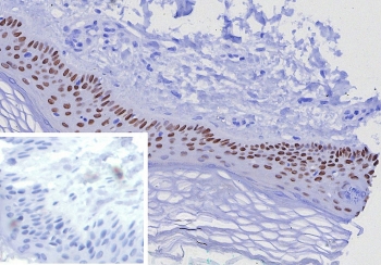 IHC staining of FFPE human skin tissue with TP63 antibody (clone TP63/7807R). Inset: PBS used in place of primary Ab (secondary Ab negative control). HIER: boil tissue sections in pH 9 10mM Tris with 1mM EDTA for 20 min and allow to cool before testing.~