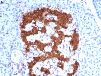 IHC staining of FFPE human pancreas tissue with PGP9.5 antibody (clone UCHL1/8152). HIER: boil tissue sections in pH 9 10mM Tris with 1mM EDTA for 20 min and allow to cool before testing.~