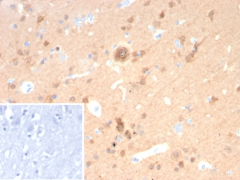 IHC staining of FFPE human cerebellum tissue with UchL1 antibody (clone rUCHL1/8057). Inset: PBS used in place of primary Ab (secondary Ab negative control). HIER: boil tissue sections in pH 9 10mM Tris with 1mM EDTA for 20 min and allow to cool before testing.~