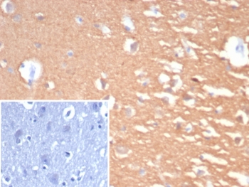 IHC staining of FFPE human cerebellum tissue with PGP9.5 antibody (clone UCHL1/7076R). Inset: PBS used in place of primary Ab (secondary Ab negative control). HIER: boil tissue sections in pH 9 10mM Tris with 1mM EDTA for 20 min and allow to cool before testing.~