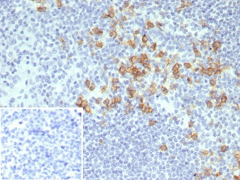 IHC staining of FFPE human tonsil tissue with CD38 antibody (clone CD38/8075R). Inset: PBS used in place of primary Ab (secondary Ab negative control). HIER: boil tissue sections in pH 9 10mM Tris with 1mM EDTA for 20 min and allow to cool before testing.~