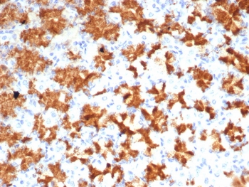 IHC staining of FFPE human stomach tissue with Interleukin-2 antibody (clone IL2/4985). HIER: boil tissue sections in pH 9 10mM Tris with 1mM EDTA for 20 min and allow to cool before testing.~