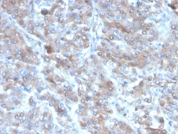 IHC staining of FFPE human adrenal gland tissu