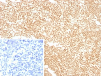 IHC staining of FFPE human tonsil tissue with LDB2 antibody (clone PCRP-LDB2-1B10). Inset: PBS used in place of primary Ab (secondary Ab negative control). HIER: boil tissue sections in pH 9 10mM Tris with 1mM EDTA for 20 min and allow to cool before testing.