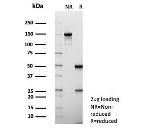 SDS-PAGE analysis of purified, BSA-free S100P antibody (clone S100P/7373) as confirmation of integrity and purity.