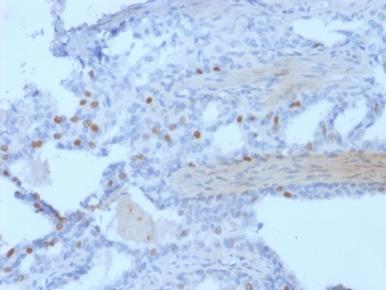 IHC staining of FFPE human prostate tissue with PCGF3 antibody (clone PCRP-PCGF3-1D5) HIER: boil tissue sections in pH 9 10mM Tris with 1mM EDTA for 20 min and allow to cool before testing.~