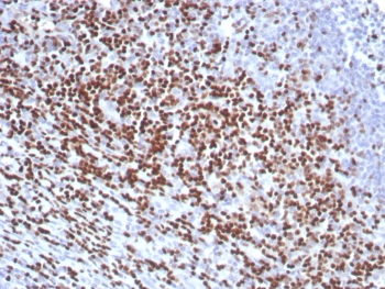 IHC staining of FFPE human tonsil tissue with LEF1 antibody (clone rLEF1/8854). HIER: boil tissue sections in pH 9 10mM Tris with 1mM EDTA for 20 min and allow to cool before testing.~