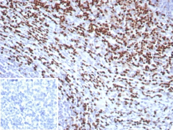 IHC staining of FFPE human tonsil tissue with LEF1 ant