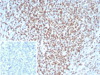 IHC staining of FFPE analysis of human tonsil tissue with Lymphoid enhancer-binding factor 1 antibody (clone LEF1/8629R). Strong nuclear staining of non-germinal center cells observed. Inset: PBS used in place of primary Ab (secondary Ab negative control). HIER: boil tissue sections in pH 9 10mM Tris with 1mM