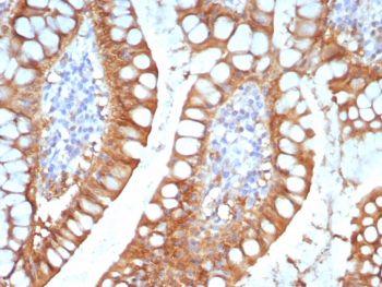 IHC staining of FFPE human small intestine tissue with I-FABP antibody (clone FABP2/7670). HIER: boil tissue sections in pH 9 10mM Tris with 1mM EDTA for 20 min and allow to cool before testing.~