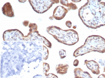 IHC staining of FFPE human placental tissue with bFGF antibody (clone FGF2/7364). Inset: PBS used in place of primary Ab (secondary Ab negative control). HIER: boil tissue sections in pH 9 10mM Tris with 1mM EDTA for 20 min and allow to cool before testing.~