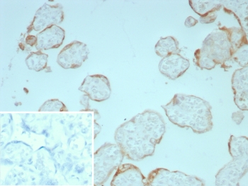 IHC staining of FFPE human placental tissue with FGF2 antibody (clone FGF2/7365). Inset: PBS used in place of primary Ab (secondary Ab negative control). HIER: boil tissue sections in pH 9 10mM Tris with 1mM EDTA for 20 min and allow to cool before testing.~