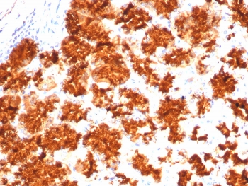 IHC staining of FFPE human stomach tissue with Interleukin-2 antibody (clone IL2/4983). HIER: boil tissue sections in pH 9 10mM Tris with 1mM EDTA for 20 min and allow to cool before testing.~