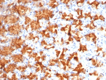 IHC staining of FFPE human stomach tissue with Interleukin-2 antibody (clone IL2/4986). HIER: boil tissue sections in pH 9 10mM Tris with 1mM EDTA for 20 min and allow to cool before testing.~