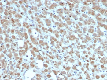 IHC staining of FFPE human adrenal gland tissue with Interleukin-2 (IL-2) antibody (clone IL2/7359). HIER: boil tissue sections in pH 9 10mM Tris with 1mM EDTA for 20 min and allow to cool before testing.~