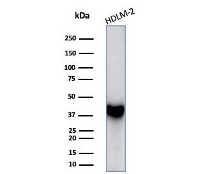 Western blot testing of human HDLM-2 cell lysate with STING1 antibody (clone STING1/7435). Predicted molecular weight ~42 kDa.~