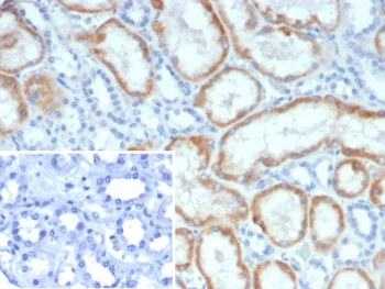 IHC staining of FFPE human kidney tissue with Mineralocorticoid Receptor antibody (clone NR3C2/4900). Inset: PBS used in place of primary Ab (secondary Ab negative control). HIER: boil tissue sections in pH 9 10mM Tris with 1mM EDTA for 20 min and allow to cool before testing.~