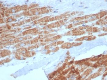 IHC staining of FFPE human heart tissue with SDHA antibody (clone SDHA/7495). HIER: boil tissue sections in pH 9 10mM Tris with 1mM EDTA for 20 min and allow to cool before testing.~