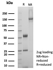 SDS-PAGE analysis of purified, BSA-free SDHA antibody (c