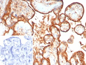 IHC staining of FFPE human placental tissue with Hexosaminidase B antibody (clone HEXB/7762). Inset: PBS used in place of primary Ab (secondary Ab negative control). HIER: boil tissue sections in pH 9 10mM Tris with 1mM EDTA for 20 min and allow to cool before testing.~