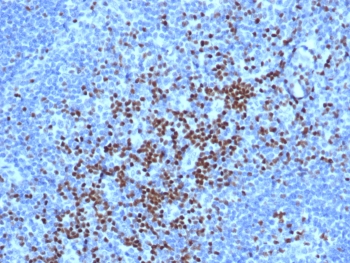 IHC staining of FFPE human lymph node tissue with TCF7 antibody (clone TCF7/7631). HIER: boil tissue sections in pH 9 10mM Tris with 1mM EDTA for 20 min and allow to cool before testing.~