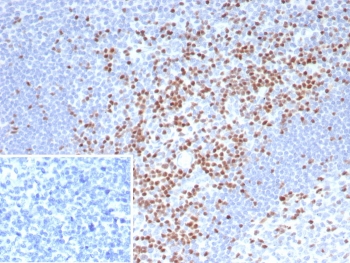 IHC staining of FFPE human tonsil tissue with TCF7