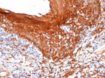 IHC staining of FFPE human tonsil tissue with STING1 antibody (clone STING1/7441). HIER: boil tissue sections in pH 9 10mM Tris with 1mM EDTA for 20 min and allow to cool before testing.~
