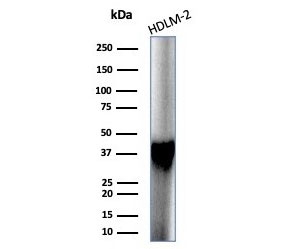 Western blot testing of human HDLM-2 cell lysate with STING1 antibody (clone STING1/7433). Predicted molecular weight ~42 kDa.~