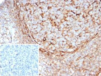 IHC staining of FFPE human tonsil tissue with Stimulator of interferon genes protein antibody (clone STING1/7434). Inset: PBS used in place of primary Ab (secondary Ab negative control). HIER: boil tissue sections in pH 9 10mM Tris with 1mM EDTA for 20 min and allow to cool before testing.~