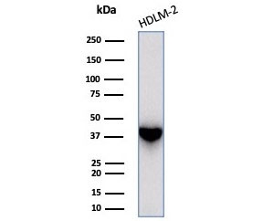 Western blot testing of human HDLM-2 cell lysate with STING1 antibody (clone STING1/7437). Predicted molecular weight ~42 kDa.~