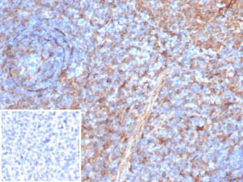 IHC staining of FFPE human tonsil tissue with STING1 antibody (clone STING1/7437). Inset: PBS used in place of