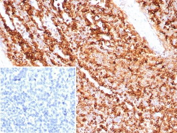 IHC staining of FFPE human tonsil tissue with CD74 antibody (clone CLIP/7945) at 2ug/ml. Inset: PBS used in place of primary Ab (secondary Ab negative control). HIER: boil tissue sections in pH 9 10mM Tris with 1mM EDTA for 20 min and allow to cool before testing.~