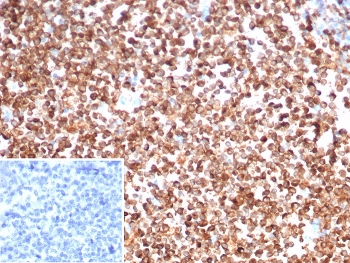 IHC staining of FFPE human spleen tissue with CD74 antibody (clone CLIP/7194) at 2ug/ml. Inset: PBS used in place of primary Ab (secondary Ab negative control). HIER: boil tissue sections in pH 9 10mM Tris with 1mM EDTA for 20 min and allow to cool before testing.~