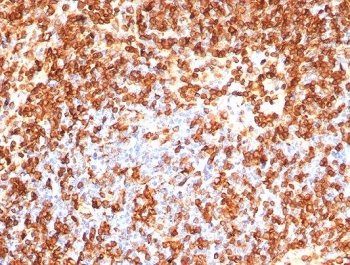 IHC staining of FFPE human spleen tissue with CD74 antibody (clone CLIP/7192) at 2ug/ml. HIER: boil tissue sections in pH 9 10mM Tris with 1mM EDTA for 20 min and allow to cool before testing.~