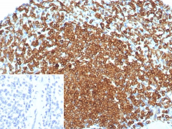 IHC staining of FFPE human spleen tissue with CD74 antibody (clone rCLIP/8679). Inset: PBS used in place of primary Ab (secondary Ab negative control). HIER: boil tissue sections in pH 9 10mM Tris with 1mM EDTA for 20 min and allow to cool before testing.~