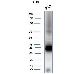 Western blot testing of human Raji cell lysate with CD74 antibody (clone CLIP/8680R). Expected molecular weight: 33-43 kDa.~