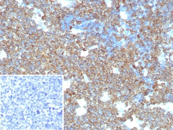 IHC staining of FFPE human tonsil tissue with CD74 antibody (clone CLIP/8680R). Inset: PBS used in place of primar