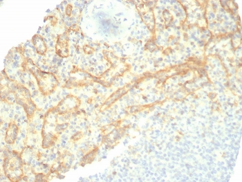 IHC staining of FFPE human spleen tissue with TIM3 antibody (clone TIM3/6863R). HIER: boil tissue sections in pH 9 10mM Tris with 1mM EDTA for 20 min and allow to cool before testing.~