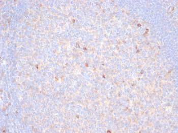 IHC staining of FFPE human tonsil tissue with TIM3 ant