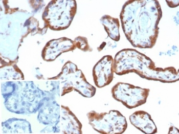 IHC staining of FFPE human placental tissue with VEGF antibody (clone VEGFA/7635R). Inset: PBS used in place of primary Ab (secondary Ab negative control). HIER: boil tissue sections in pH 9 10mM Tris with 1mM EDTA for 20 min and allow to cool before testing.~