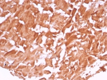 IHC staining of FFPE human heart tissue with VEGF antibody (clone VEGFA/7636R). HIER: boil tissue sections in pH 9 10mM Tris with 1mM EDTA for 20 min and allow to cool before testing.~