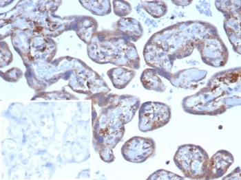 IHC staining of FFPE human placental tissue with VEGF
