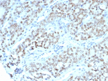IHC staining of FFPE human fallopian tube tissue with BTBD9 antibody (clone BTBD9/7501). HIER: boil tissue sections in pH 9 10mM Tris with 1mM EDTA for 20 min and allow to cool before testing.~
