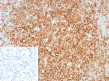 IHC staining of FFPE human tonsil tissue with HLA-DR antibody (clone rHLA-DRA/8285). Inset: PBS used in place of primary Ab (secondary Ab negative control). HIER: boil tissue sections in pH 9 10mM Tris with 1mM EDTA for 20 min and allow to cool before testing.~