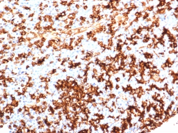 IHC staining of FFPE human tonsil tissue with HLA-DR antibody (clone HLA-DRA/6839R). HIER: boil tissue sections in pH 9 10mM Tris with 1mM EDTA for 20 min and allow to cool before testing.~