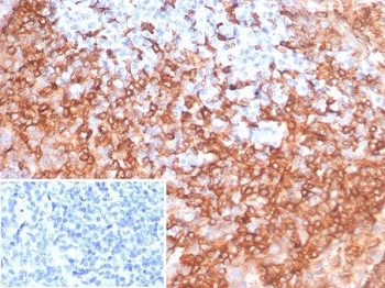 IHC staining of FFPE human tonsil tissue with HLA-DR antibody (clone HLA-DRB/7058R). Inset: PBS used in place of primary Ab (secondary Ab negative control). HIER: boil tissue sections in pH 9 10mM Tris with 1mM EDTA for 20 min and allow to cool before testing.~