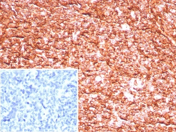 IHC staining of FFPE human tonsil tissue with HLA 1 ABC antibody (clone MHC-I/8147R). Inset: PBS used in place of primary Ab (secondary Ab negative control). HIER: boil tissue sections in pH 9 10mM Tris with 1mM EDTA for 20 min and allow to cool before testing.~