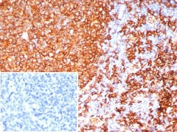 IHC staining of FFPE human tonsil tissue with