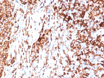 IHC staining of FFPE human tonsil tissue with HLA-DR antibody (clone HLA-DRA/6840R). HIER: boil tissue sections in pH 9 10mM Tris with 1mM EDTA for 20 min and allow to cool before testing.~